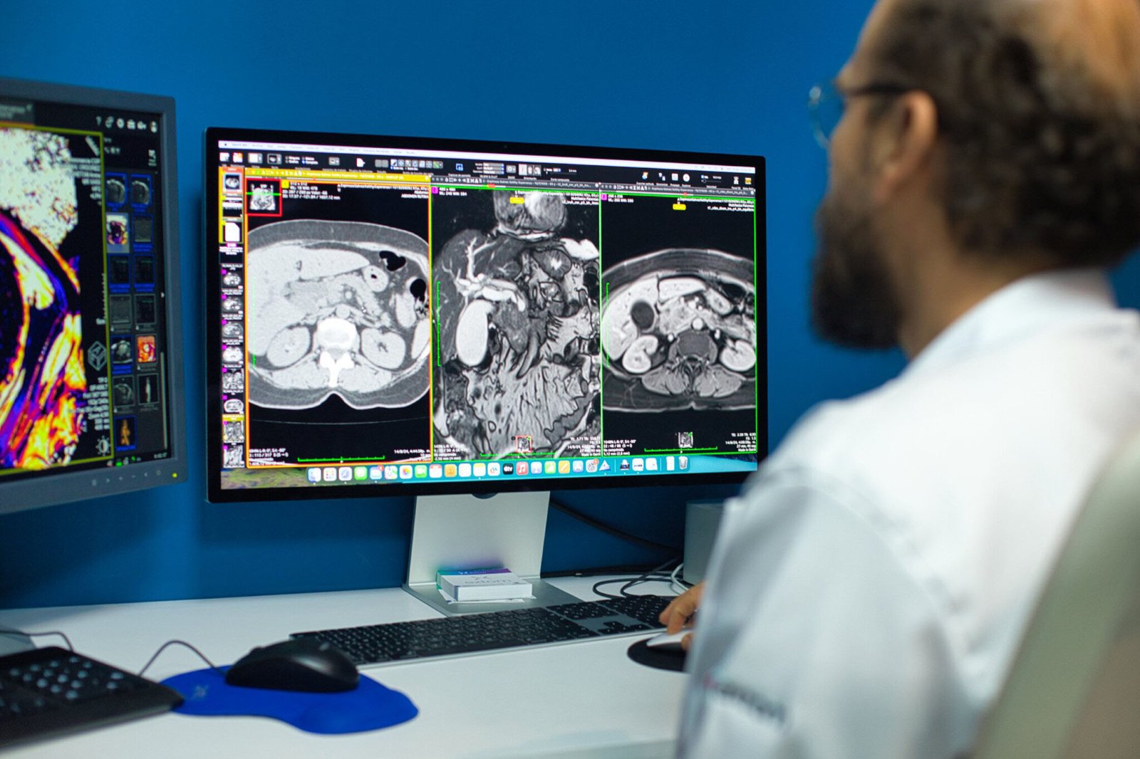 Unidad de imagen corporal - Extom